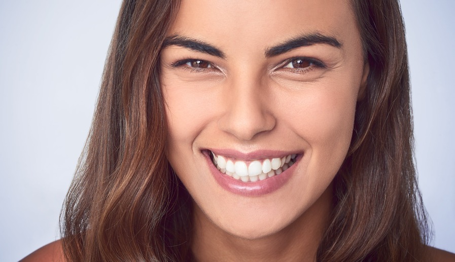Para que sirven las carillas dentales